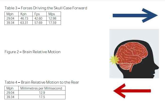 BRAIN-MOTION_24-06-2015-2-27-24-AM_Q10_700x455